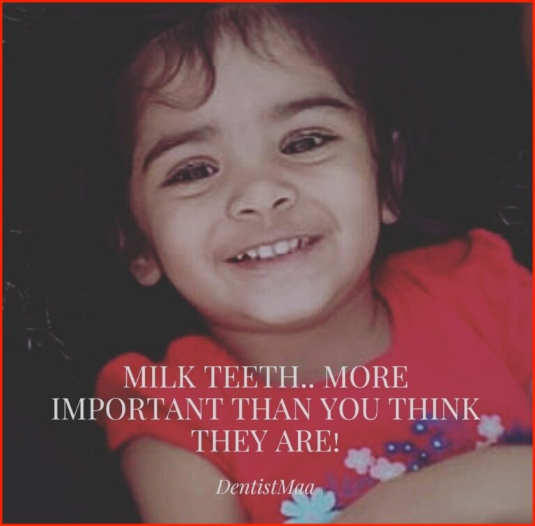 Read more about the article Milk teeth… More important than you think they are!!