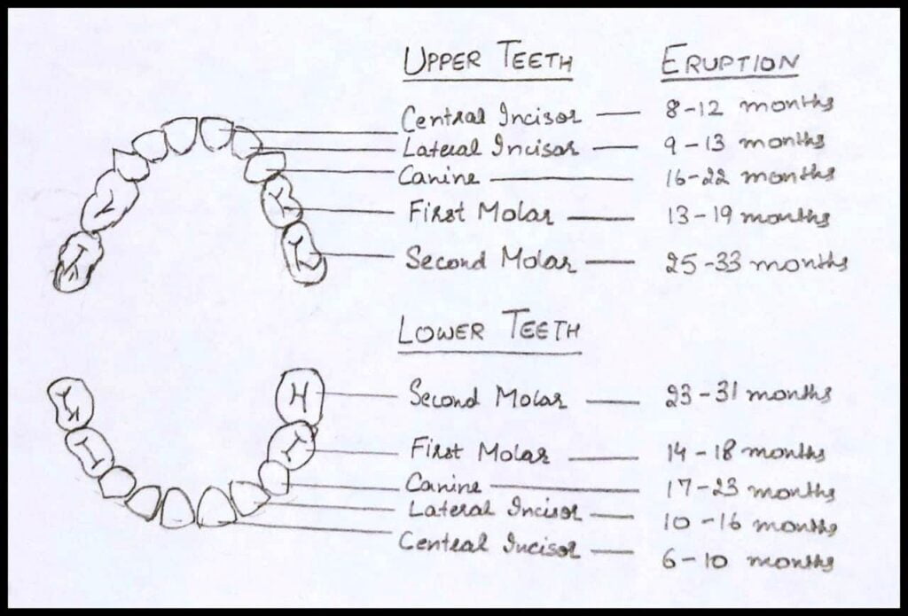 eruption sequence of primary (milk) teeth
