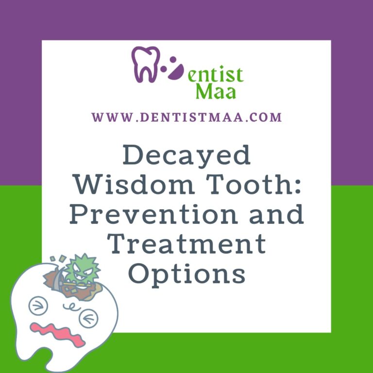 Read more about the article Decayed Wisdom Tooth: Prevention and Treatment Options