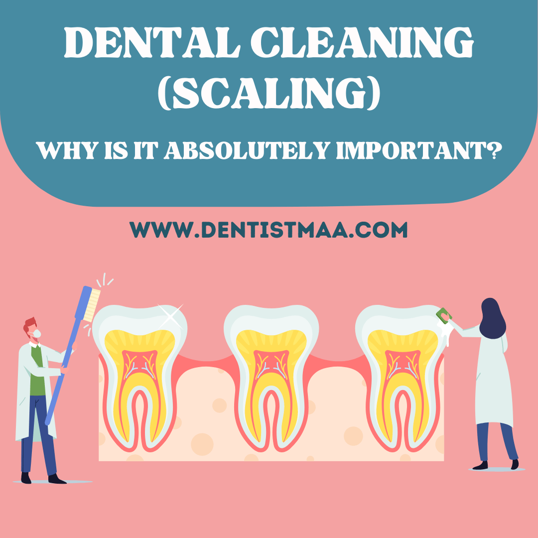 Dental Cleaning (Scaling): Why is it absolutely important?