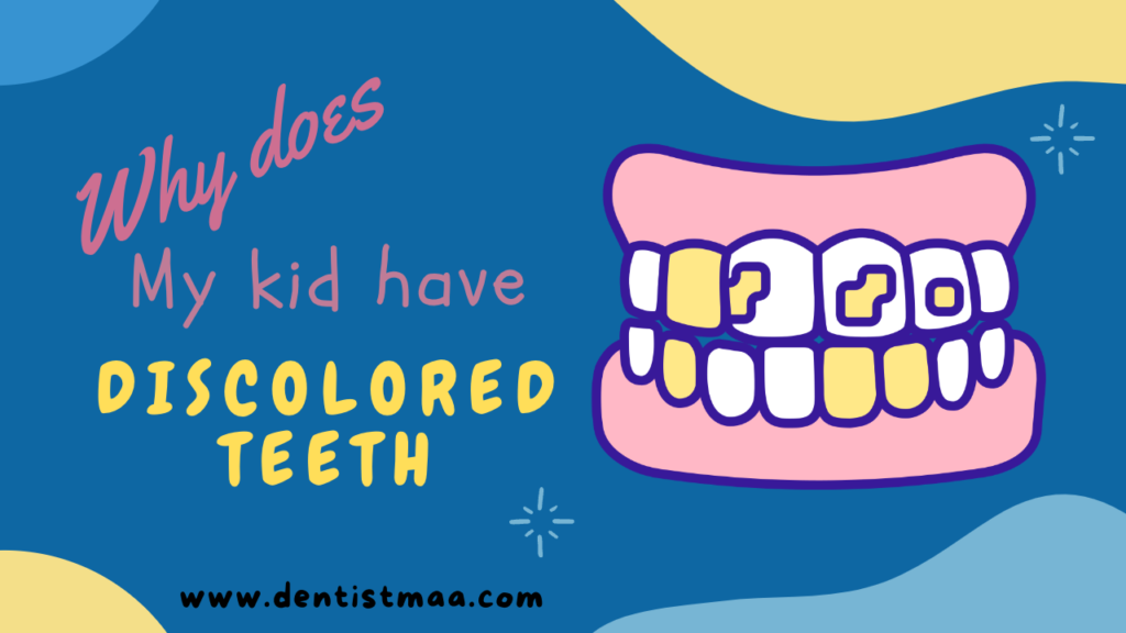 discoloured teeth , chromogenic bacteria, black stains, kids teeth