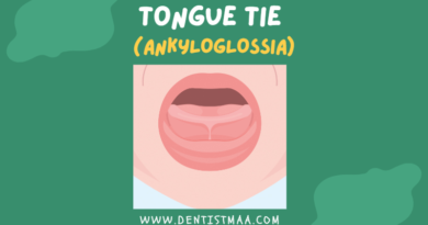 Tongue tie, Ankyloglossia