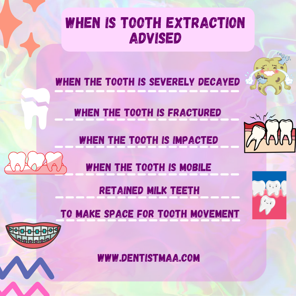 extraction, when is tooth extraction advised