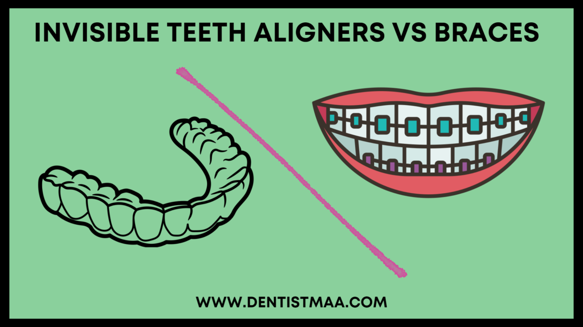 Invisible Teeth Aligners vs Braces DentistMaa