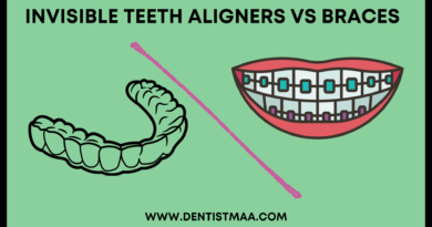 invisible teeth aligner, braces, invisible teeth aligner vs braces