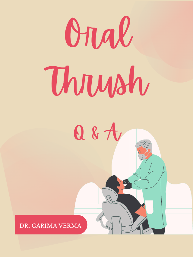 Oral Thrush: Q & A