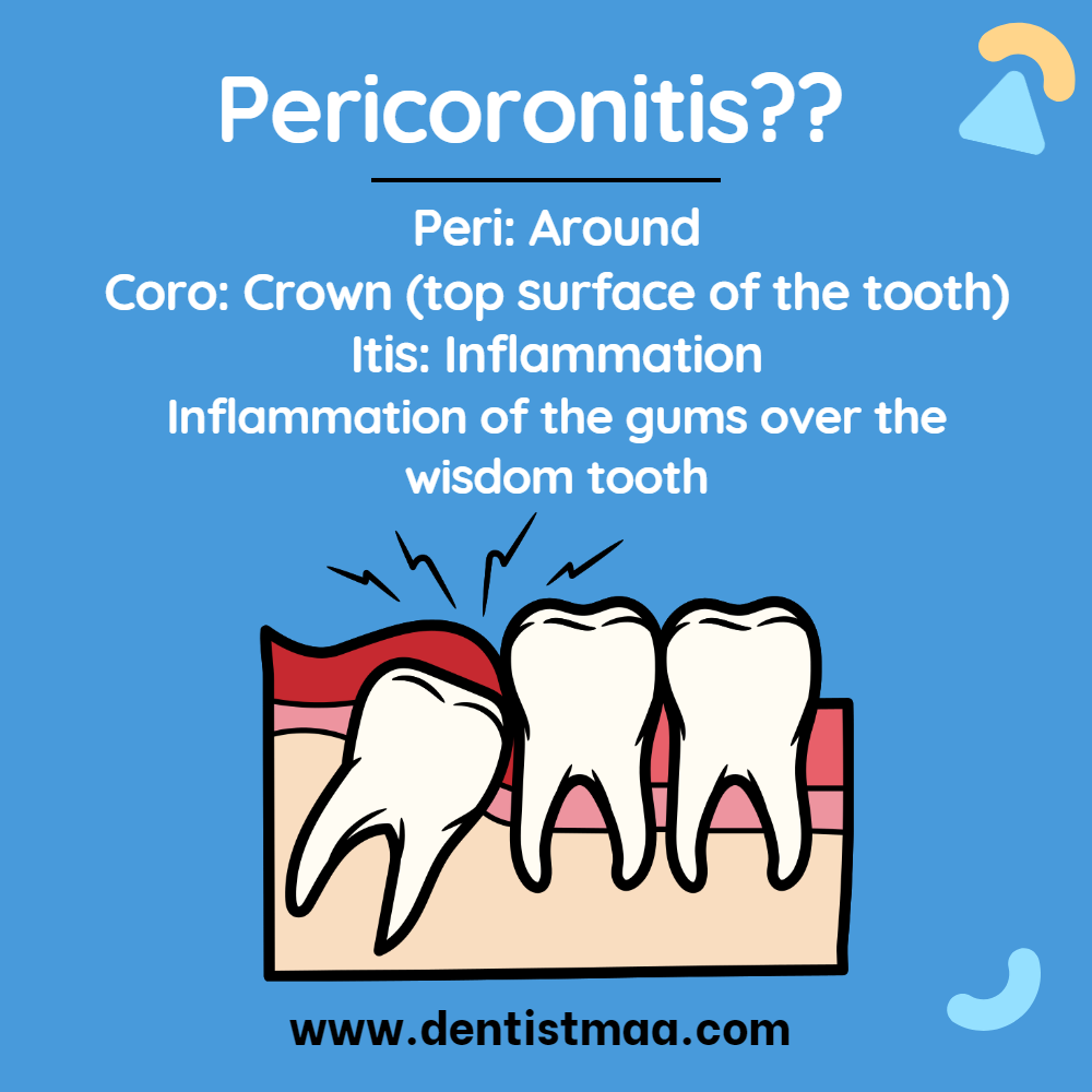 Pericoronitis, wisdom tooth, wisdom teeth, third molars