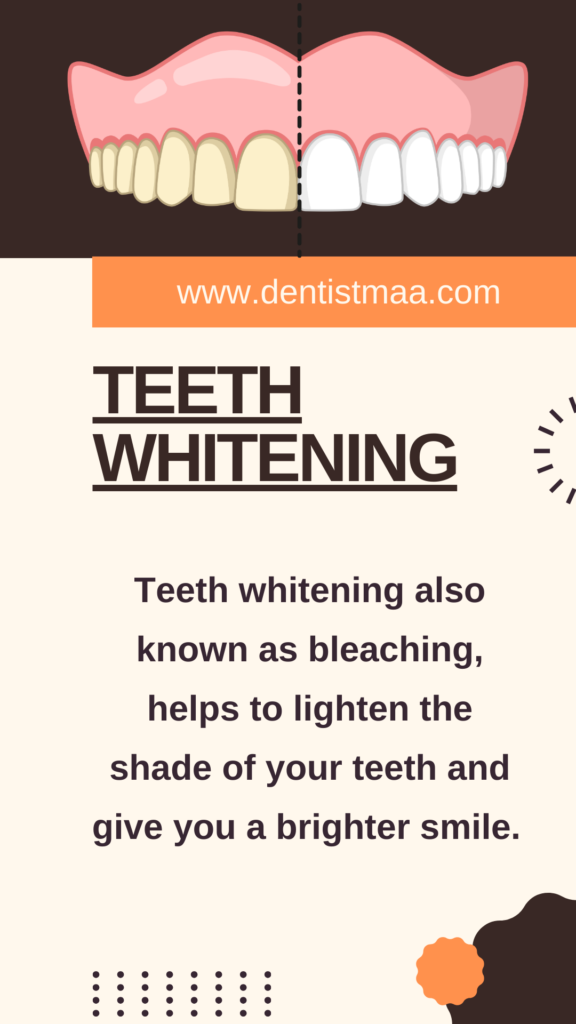 cosmetic dentistry, teeth whitening, smile, bright smile, white teeth, sparkly teeth