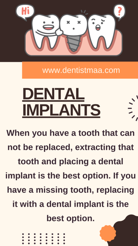 dental implants, missing teeth, teeth, decayed teeth