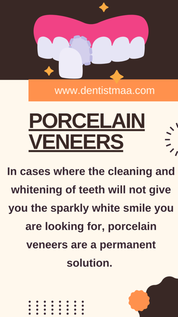 porcelian veneers, veners, smile, bright smile