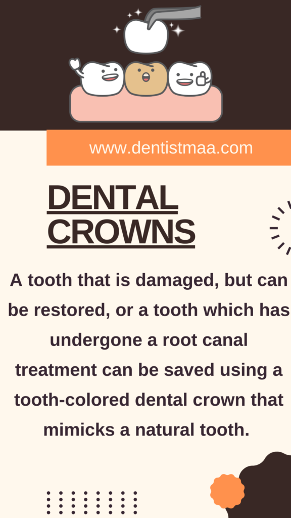 dental crowns, decayed teeth, root canal treatment, rct