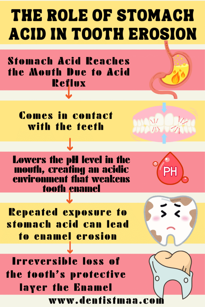 acid reflux, stomach,  tooth erosion, pH. dentin, enamel